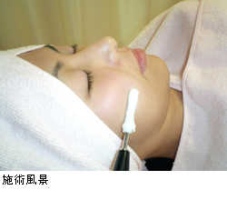 イオン導入